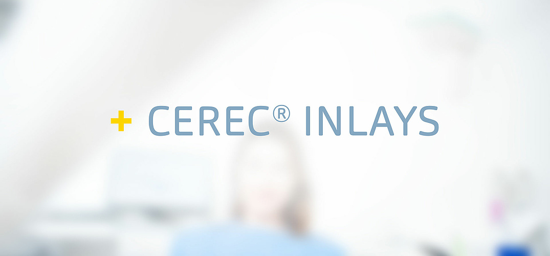 Cerec Inlays