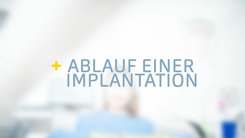 Ablauf einer Implantation