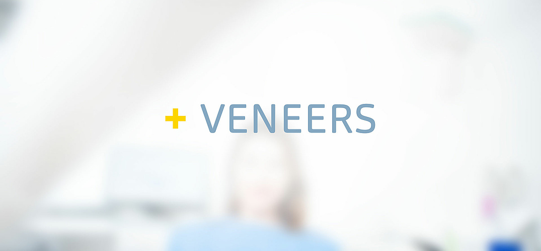 Veneers