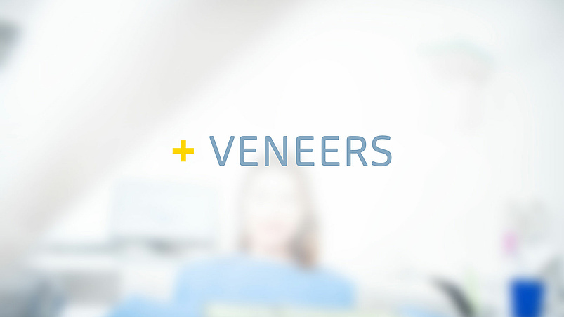 Veneers